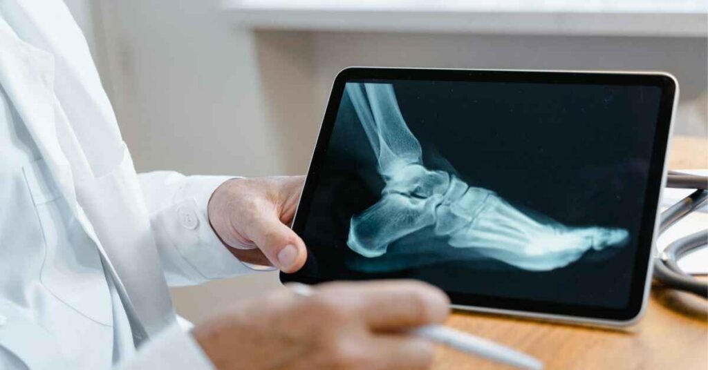 heel x-ray